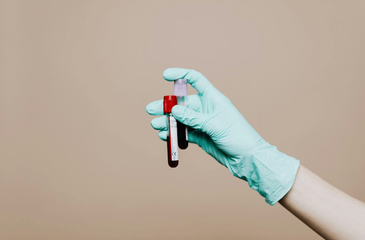 Frauengesundheit im Fokus: Die wichtigsten Vorsorgeuntersuchungen